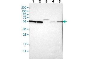 Western blot analysis of Lane 1: RT-4, Lane 2: U-251 MG, Lane 3: Human Plasma, Lane 4: Liver, Lane 5: Tonsil with SLC15A4 polyclonal antibody  at 1:250-1:500 dilution.