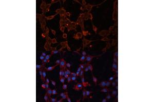 Immunofluorescence analysis of NIH/3T3 cells using SLC25 antibody (ABIN6132766, ABIN6147924, ABIN6147926 and ABIN6217967) at dilution of 1:100. (SLC25A27 antibody  (AA 1-245))