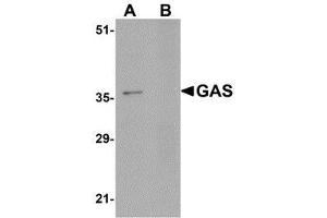 Western blot analysis of GAS in EL4 cell lysate in (A) the absence and (B) the presence of blocking peptide with AP30357PU-N GAS antibody at 1μg/ml. (Gastrin antibody  (C-Term))
