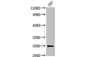Western Blot Positive WB detected in: U87 whole cell lysate All lanes: RGS2 antibody at 3 μg/mL Secondary Goat polyclonal to rabbit IgG at 1/50000 dilution Predicted band size: 25, 24, 23, 21 kDa Observed band size: 25 kDa