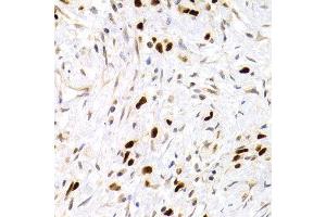 Immunohistochemistry (IHC) image for anti-Tumor Protein P53 (TP53) antibody (ABIN3017541) (p53 antibody)