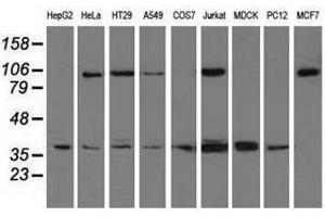 Image no. 2 for anti-X-Ray Repair Complementing Defective Repair in Chinese Hamster Cells 1 (XRCC1) antibody (ABIN1501770) (XRCC1 antibody)