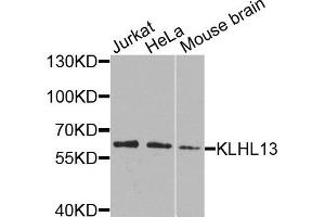 Western blot analysis of extracts of various cells, using KLHL13 antibody. (KLHL13 antibody)