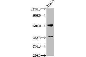 Western Blot Positive WB detected in: Rat brain tissue All lanes: Chrm1 antibody at 5. (CHRM1 antibody  (AA 210-366))