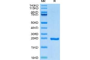 Human Sonic Hedgehog (Shh) on Tris-Bis PAGE under reduced condition. (Sonic Hedgehog Protein (SHH) (AA 24-197))