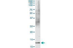 Immunoprecipitation of FABP1 transfected lysate using anti-FABP1 monoclonal antibody and Protein A Magnetic Bead , and immunoblotted with FABP1 MaxPab rabbit polyclonal antibody. (FABP1 antibody  (AA 1-127))