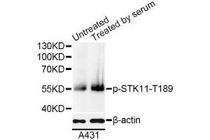 Western blot analysis of extracts of A431 cells, using Phospho-STK11-T189 antibody (ABIN5995630) at 1/1000 dilution. (LKB1 antibody  (pThr189))