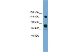 WB Suggested Anti-AGTPBP1 Antibody Titration: 0. (AGTPBP1 antibody  (N-Term))