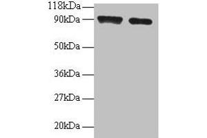 Western blot All lanes: SAT1 antibody at 2 μg/mL Lane 1: 293T whole cell lysate Lane 2: EC109 whole cell lysate Secondary Goat polyclonal to rabbit IgG at 1/15000 dilution Predicted band size: 21 kDa Observed band size: 90 kDa (SAT1 antibody  (AA 5-171))