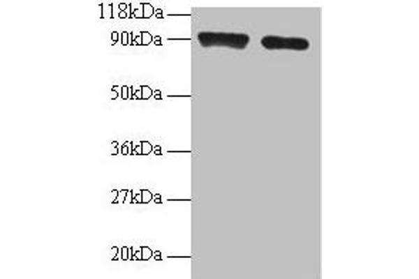 SAT1 anticorps  (AA 5-171)