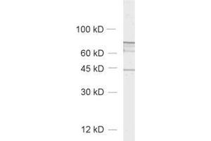 Western Blotting (WB) image for anti-ELK3, ETS-Domain Protein (SRF Accessory Protein 2) (ELK3) (AA 189-204) antibody (ABIN1742519) (ELK3 antibody  (AA 189-204))