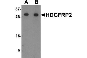 Western blot analysis of HDGFRP2 in human testis tissue lysate with HDGFRP2 antibody at (A) 0. (HDGFRP2 antibody  (N-Term))
