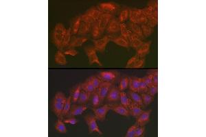 Immunofluorescence analysis of U2OS cells using [KO Validated] SOD2 Rabbit pAb (ABIN3021903, ABIN3021904, ABIN3021905 and ABIN6217382) at dilution of 1:200 (40x lens). (SOD2 antibody  (AA 25-222))