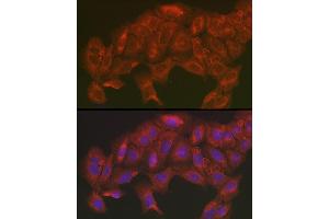 Immunofluorescence analysis of U2OS cells using [KO Validated] SOD2 Rabbit pAb (ABIN3021903, ABIN3021904, ABIN3021905 and ABIN6217382) at dilution of 1:200 (40x lens). (SOD2 antibody  (AA 25-222))