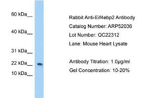 Western Blotting (WB) image for anti-Eukaryotic Translation Initiation Factor 4E Binding Protein 2 (EIF4EBP2) (N-Term) antibody (ABIN2784743) (eIF4EBP2 antibody  (N-Term))