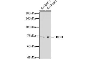 Western blot analysis of extracts of various cell lines, using FBLN1 Rabbit pAb (ABIN7267200) at 1:2000 dilution. (Fibulin 1 antibody  (AA 570-670))