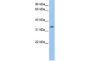 WB Suggested Anti-LACTB Antibody Titration: 0. (LACTB antibody  (Middle Region))