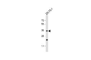 Anti-OR2L8 Antibody (C-term) at 1:1000 dilution + ZR-75-1 whole cell lysate Lysates/proteins at 20 μg per lane.