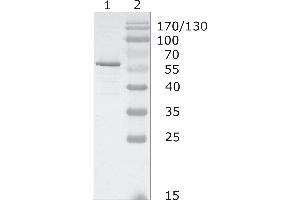 Western-Blot analysis of HIV-1 HAN subtype gag protein using HIV-1 p24 (05-001) antibody. (HIV-1 p24 antibody  (AA 48-62))