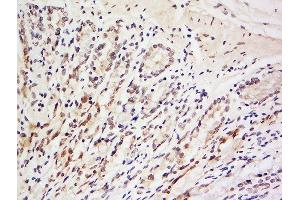 LRRC39 antibody  (AA 101-200)