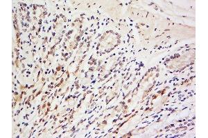 Formalin-fixed and paraffin embedded rat brain labeled with Anti-LRRC39 Polyclonal Antibody, Unconjugated  at 1:200 followed by conjugation to the secondary antibody and DAB staining. (LRRC39 antibody  (AA 101-200))