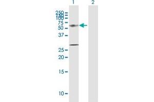 Western Blot analysis of KRT12 expression in transfected 293T cell line by KRT12 MaxPab polyclonal antibody. (KRT12 antibody  (AA 1-494))