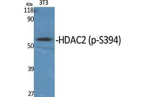 Western Blot (WB) analysis of specific cells using Phospho-HDAC2 (S394) Polyclonal Antibody. (HDAC2 antibody  (pSer394))