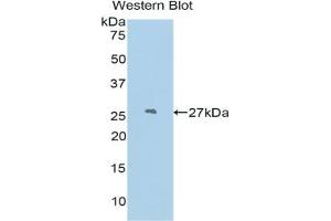 Detection of Recombinant PDCN, Mouse using Polyclonal Antibody to Podocin (PDCN) (Podocin antibody  (AA 138-371))