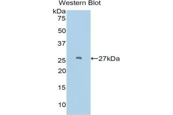 Podocin anticorps  (AA 138-371)