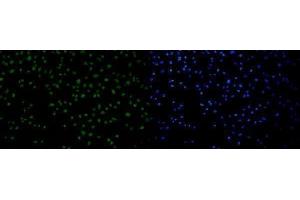 IF analysis of 53BP1/TP53BP1 using anti-53BP1/TP53BP1 antibody (ABIN7599869).