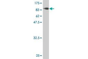 Western Blot detection against Immunogen (101. (LIMK2 antibody  (AA 1-686))