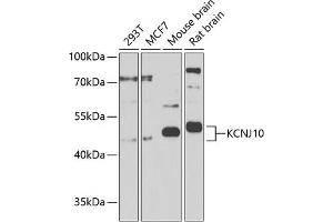 Western blot analysis of extracts of various cell lines, using KCNJ10 Antibody (ABIN6134092, ABIN6142719, ABIN6142720 and ABIN6225135) at 1:1000 dilution. (KCNJ10 antibody  (AA 50-150))