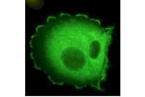Immunofluorescence microscopy using  Monoclonal anti-HEF1 antibody (clone 2G9) shows detection of HEF1 localized at focal adhesion sites. (NEDD9 antibody  (AA 82-398, AA 843))
