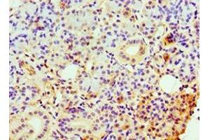 Immunohistochemistry of paraffin-embedded human pancreatic tissue using ABIN7147891 at dilution of 1:100