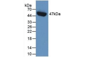 Detection of Recombinant PAI1, Human using Monoclonal Antibody to Plasminogen Activator Inhibitor 1 (PAI1) (PAI1 antibody)