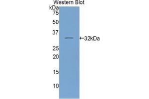 Detection of Recombinant ITIH1, Mouse using Polyclonal Antibody to Inter Alpha-Globulin Inhibitor H1 (ITIH1) (ITIH1 antibody  (AA 413-660))