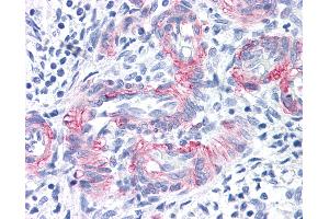 Anti-MCAM / CD146 antibody IHC of human vessels in human uterus. (MCAM antibody)