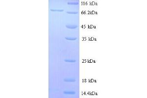 SDS-PAGE (SDS) image for Estrogen Receptor 1 (ESR1) (AA 9-591), (partial) protein (His tag) (ABIN5713438)