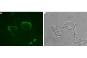 Expression of P2X1 receptor in rat PC12 cells - Cell surface detection of P2X1 receptor in intact living PC12 cells. (P2RX1 antibody  (Extracellular Loop) (Atto 488))