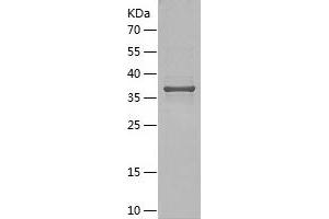 MLANA Protein (AA 1-118) (His-IF2DI Tag)