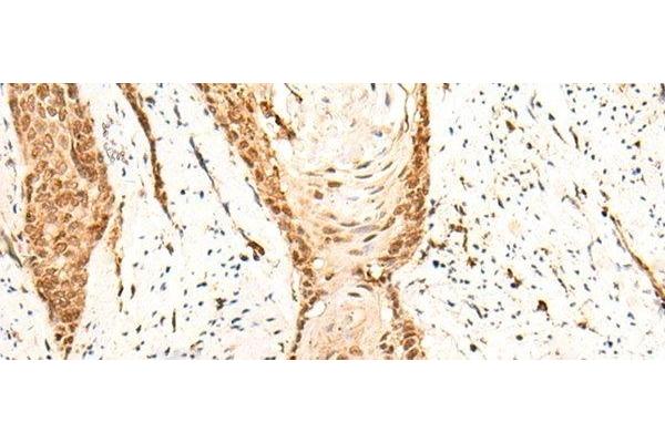 EMSY antibody