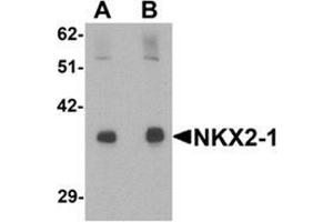 Western blot analysis of NKX2-1 in rat lung tissue lysate with NKX2-1 antibody at (A) 1 and (B) 2 ug/mL.