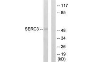 Western blot analysis of extracts from 293 cells, using SERC3 Antibody.