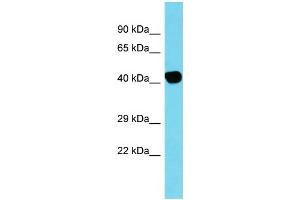 Host: Rabbit Target Name: ACTBL2 Sample Type: Placenta lysates Antibody Dilution: 1. (ACTBL2 antibody  (C-Term))