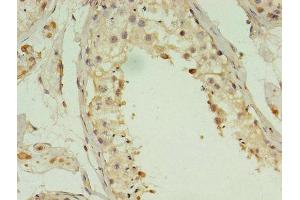 Immunohistochemistry of paraffin-embedded human testis tissue using ABIN7143208 at dilution of 1:100 (ACBD4 antibody  (AA 1-305))