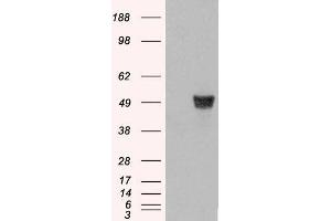 HEK293 overexpressing CORO1A (RC210753) and probed with Antibody (mock transfection in first lane). (Coronin 1a antibody  (C-Term))