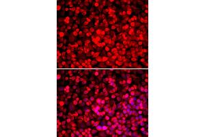 Immunofluorescence analysis of HeLa cells using PUF60 antibody (ABIN5974052).