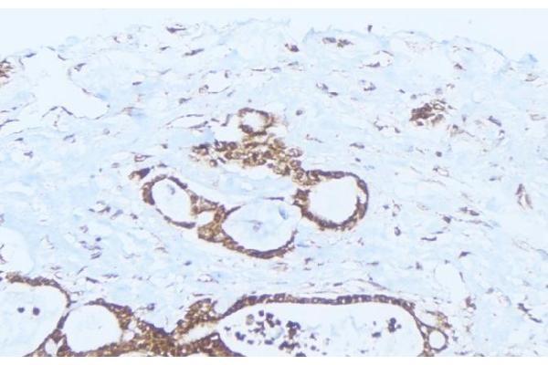 PPM1K antibody  (Internal Region)