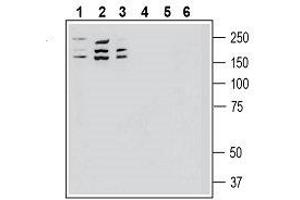 Western blot analysis of human SH-SY5Y neuroblastoma cell line lysate (lanes 1 and 4), human MDA-MB-231 breast adenocarcinoma cell line lysate (lanes 2 and 5) and human THP-1 monocytic leukemia cell line lysate (lanes 3 and 6): - 1-3. (ROBO1 antibody  (Extracellular, N-Term))