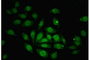 Immunofluorescent analysis of A549 cells using ABIN7176259 at dilution of 1:100 and Alexa Fluor 488-congugated AffiniPure Goat Anti-Rabbit IgG(H+L) (ZNF366 antibody  (AA 455-650))